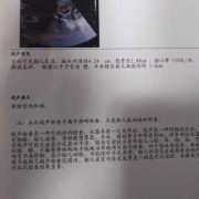 怀孕19周胎儿彩超图（19+周什么意思）