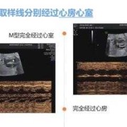胎儿心跳生（胎儿心跳生音）