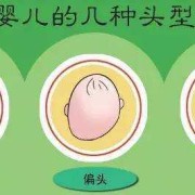 小头畸形的诊断标准是什么,如何排查胎儿小头畸形的原因