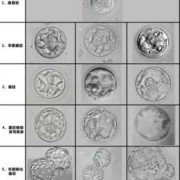 ac指胎儿的什么（ac是胎儿的什么）
