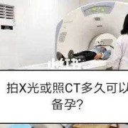 备孕可以照ct吗,男的备孕期间可以做ct吗