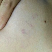 怀孕期间有血丝怎么回事（怀孕期间有血丝怎么回事呢）