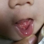 五个月的胎儿图片（婴儿5个月长牙正常吗?刚开始长的是上边的牙齿还是下边的呢）