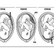 胎儿位于前壁（胎儿位于前壁和后壁有什么区别）