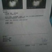 刚怀孕感冒了对胎儿有影响吗（怀孕的最初征兆1-14天）