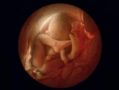 胎儿摄影（炫尼baby胎儿摄影）