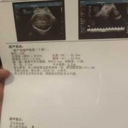 孕期39周（孕39周羊水偏多）