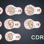 怀孕10周胎芽应该多大,怀孕10周胎儿多大