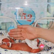 24周的胎儿能活下去吗,24周胎儿生殖图片