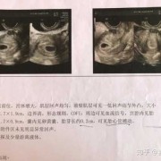 胎儿多久长胎心胎芽（怀孕多久有胎芽）
