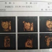 有孕期只脸胖生男孩（有孕期只脸胖生男孩还是女孩）