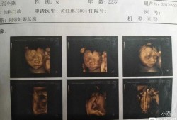 有孕期只脸胖生男孩（有孕期只脸胖生男孩还是女孩）