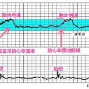 孕妇宝宝在肚子里心率多少算正常的啊,胎儿听心率能知道男女吗