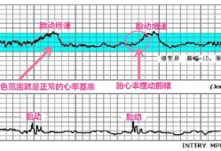孕妇宝宝在肚子里心率多少算正常的啊,胎儿听心率能知道男女吗