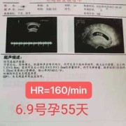 孕期胎心多少正常（孕期胎心多少正常范围）