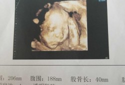 四维生育险能报多少,胎儿四维多少钱照