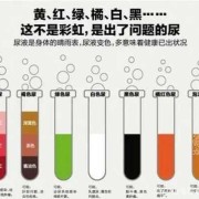 孕期尿液很黄是怎么回事,孕期尿发黄是什么原因