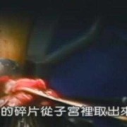 胎儿多大能做人流（胎儿多大能做人流手术）