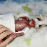 胎儿一个月能长多少斤（宝宝出生半个月就已经长了1斤了，这正常吗）