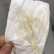 见红会引起胎儿缺氧吗（见红会引起胎儿缺氧吗）