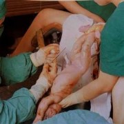 胎儿吸羊水（宝宝顺产出来了，医生说新生儿吸入羊水了，这是怎么回事）