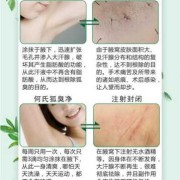 狐臭怀孕期间怎么办呢（狐臭怀孕期间怎么办呢）