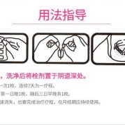 孕期阴道用药（孕晚期有阴道炎，可以用塞药吗）