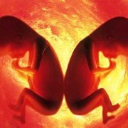 孕期双胞胎肚子变化图（孕期双胞胎肚子变化图片）