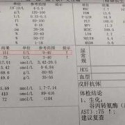 孕期谷丙转氨酶高（孕妇谷丙转氨酶偏高吃什么）