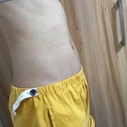孕期肚子长毛是男孩吗（孕期肚子长毛是男孩吗还是女孩）