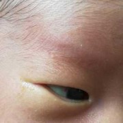 给婴儿照相伤眼睛吗,胎儿发育眼睛是第几个月