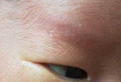 给婴儿照相伤眼睛吗,胎儿发育眼睛是第几个月