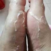 孕妇脚底脱皮是怎么回事呢,孕期皮肤干燥起皮屑怎么办
