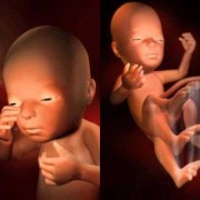 孕晚期胎儿肚子里图片（孕晚期胎儿肚子里的图）