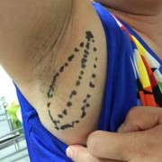 孕期腋下肿块（孕期腋下肿块是怎么回事）