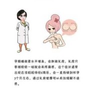 孕期乳头疼怎么缓解（乳头痛是怎么回事，有什么治疗的方法）