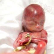 19周孩子可不可以打掉,孕19周胎儿图片欣赏