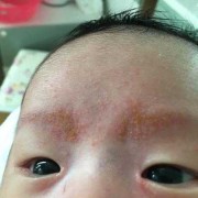 胎儿长眉毛（胎儿长眉毛妈妈什么反应）