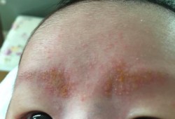 胎儿长眉毛（胎儿长眉毛妈妈什么反应）