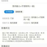 脐带血流sd偏高怎么办,胎儿sd值偏高怎么回事