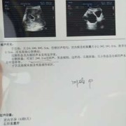 怀孕期有囊肿怎么办（怀孕期有囊肿怎么办啊）