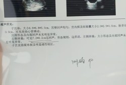 怀孕期有囊肿怎么办（怀孕期有囊肿怎么办啊）