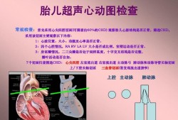 胎儿心动图是什么检查（一个胎儿超声心动图检查，必须要做吗）