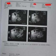 孕期怎么知道男女（孕期怎么知道男女宝宝性别）