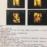 胎儿排畸形（胎儿排畸形在多少周）