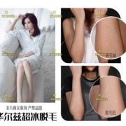 备孕期间可以激光脱毛吗（备孕期间可以激光脱毛吗）