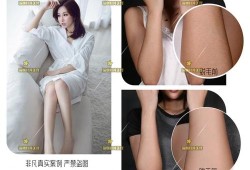 备孕期间可以激光脱毛吗（备孕期间可以激光脱毛吗）