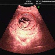 怀孕四十天怀男孩孕囊是什么样子的啊,男胎儿阴囊什么时候形成