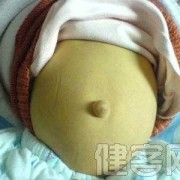 胎儿胆道闭锁孕妇症状（胎儿胆道闭锁孕妇症状有哪些）