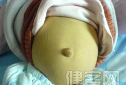 胎儿胆道闭锁孕妇症状（胎儿胆道闭锁孕妇症状有哪些）
